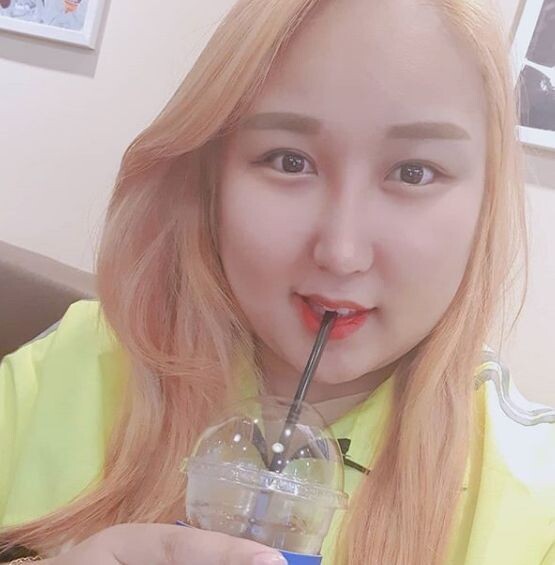 BJ풍자가 골반괴사를 고백했다 (사진, 풍자 인스타그램 캡처)