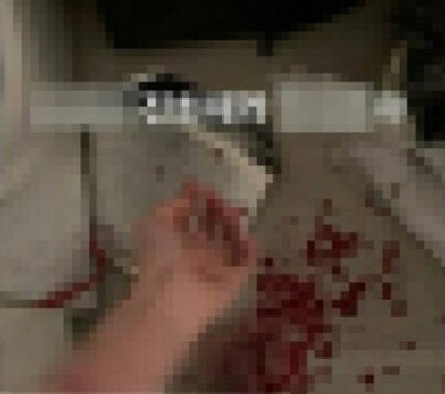 황하나가 인스타그램에 자해소동 사진을 올려 화제다 (사진, 황하나 인스타그램 캡처)