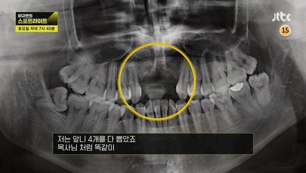 (사진=JTBC '이규연의 스포트라이트')