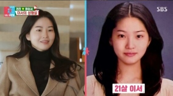 전진 아내 류이서가 화제다 (사진, SBS '동상이몽' 캡처)