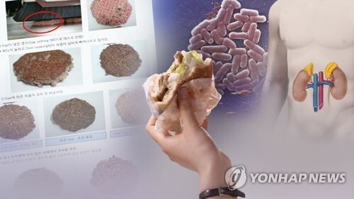 '햄버거병' 용혈성요독증후군 (CG). / 연합뉴스